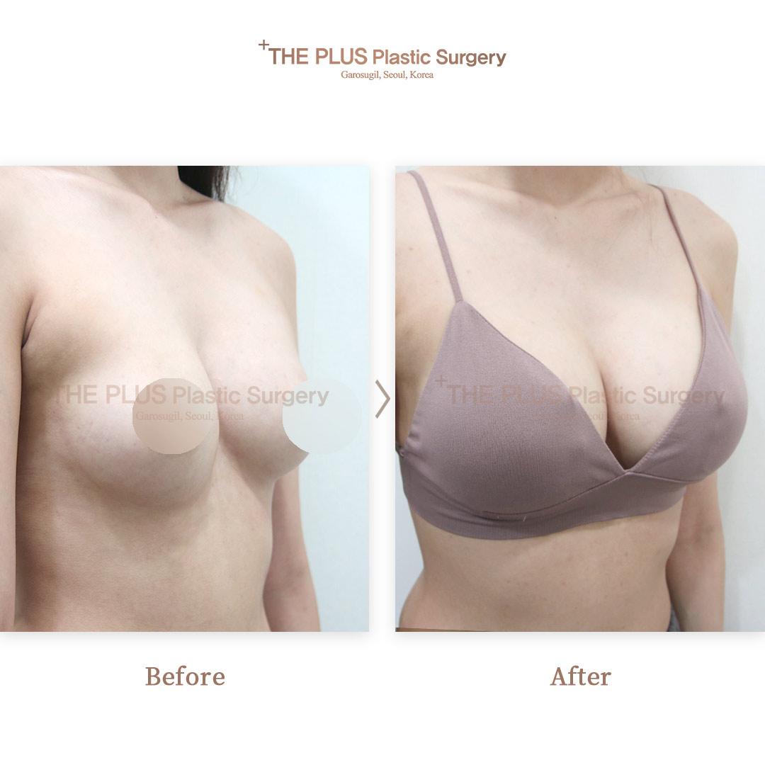 THE PLUS CLINIC KOREA -