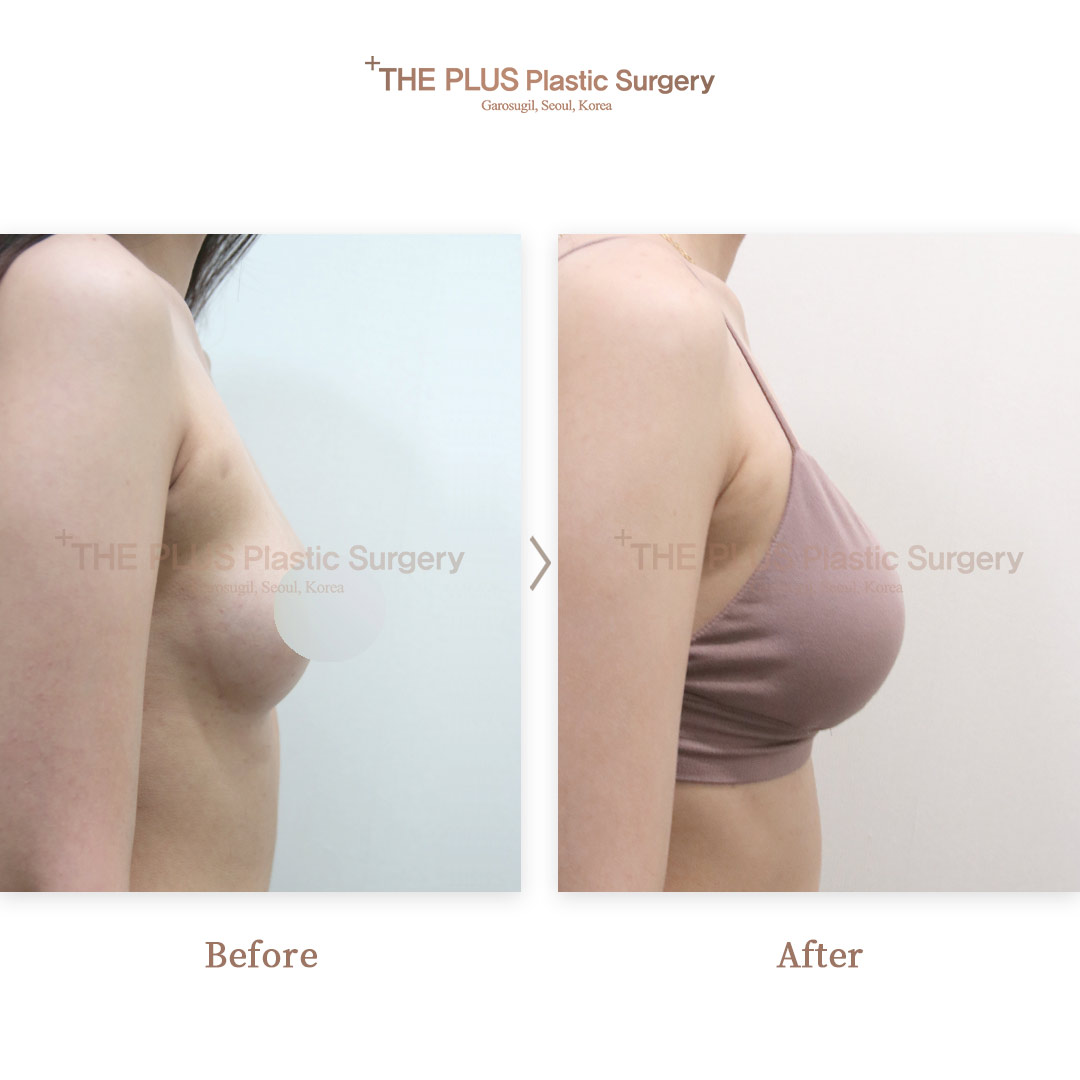 THE PLUS CLINIC KOREA -