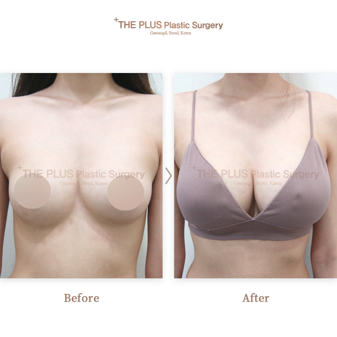 THE PLUS CLINIC KOREA -