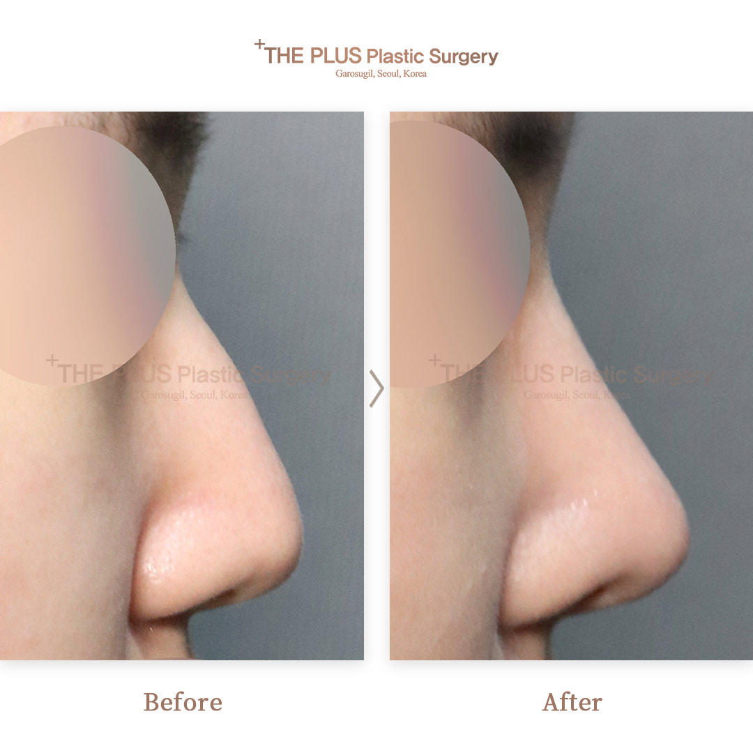 THE PLUS CLINIC KOREA -