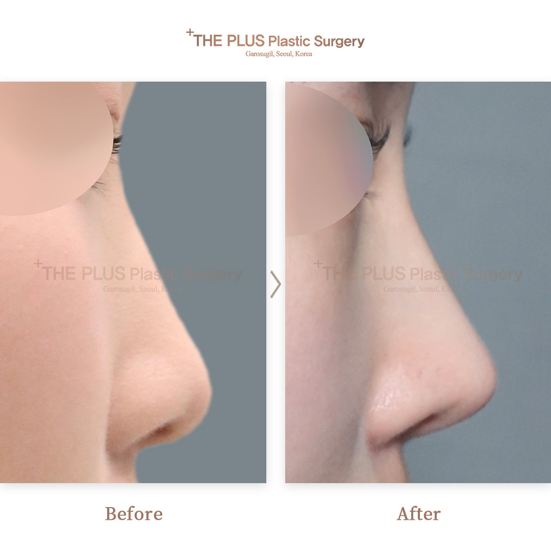 THE PLUS CLINIC KOREA -