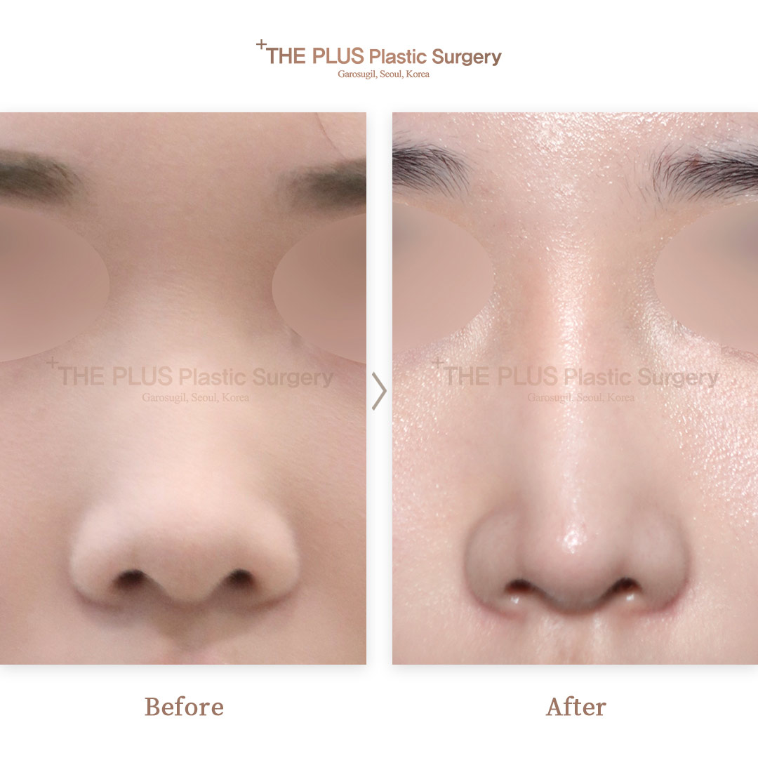 THE PLUS CLINIC KOREA -