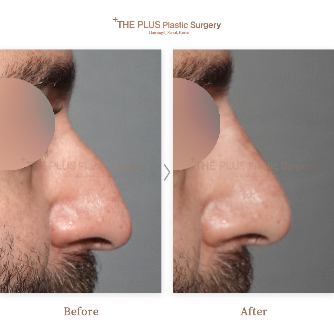 THE PLUS CLINIC KOREA -