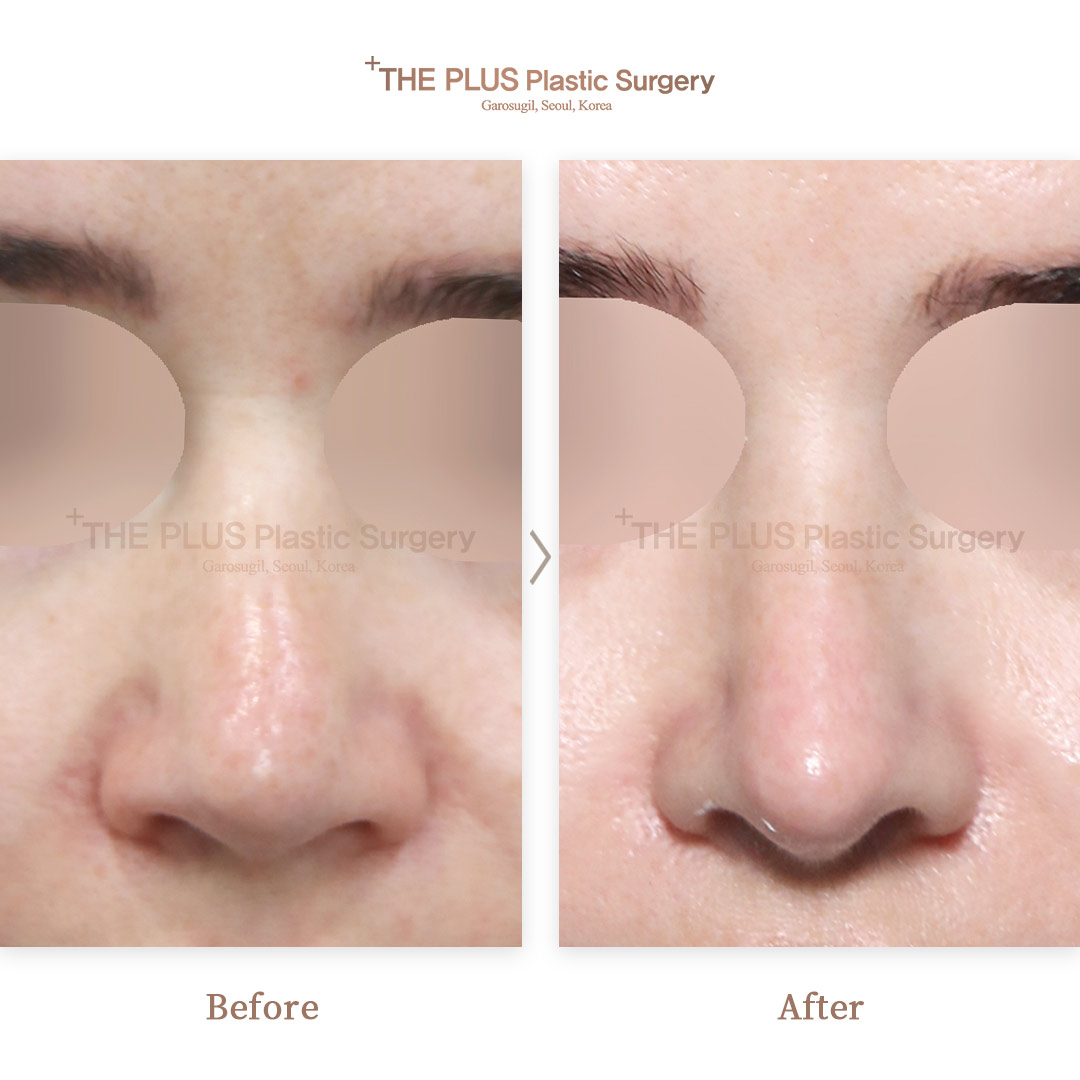 THE PLUS CLINIC KOREA -