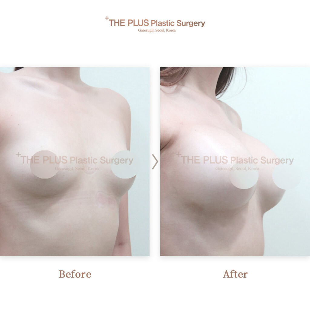 THE PLUS CLINIC KOREA -