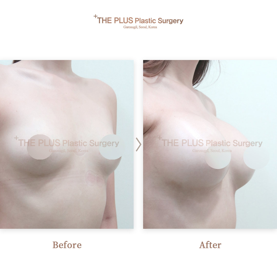 THE PLUS CLINIC KOREA -