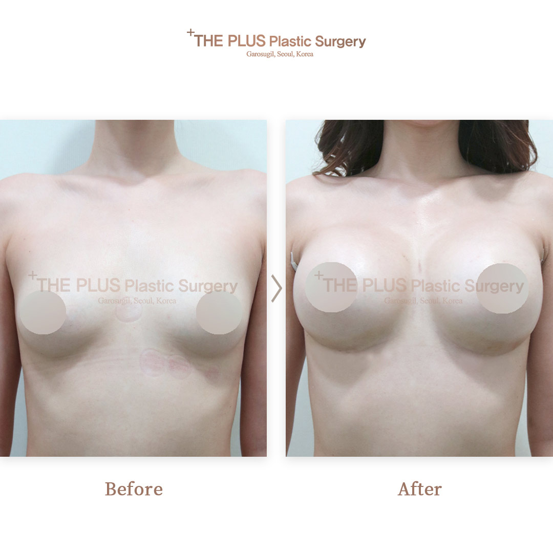 THE PLUS CLINIC KOREA -