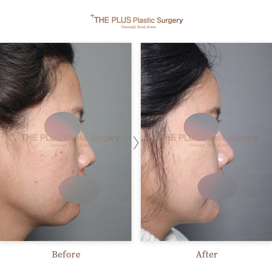 THE PLUS CLINIC KOREA -
