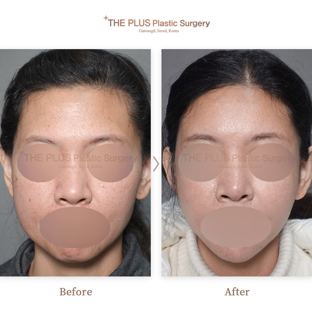 THE PLUS CLINIC KOREA -