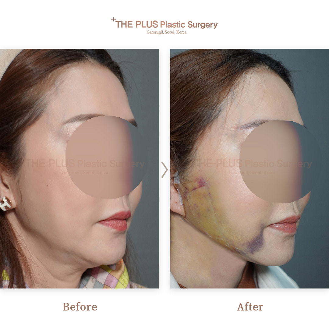 THE PLUS CLINIC KOREA -