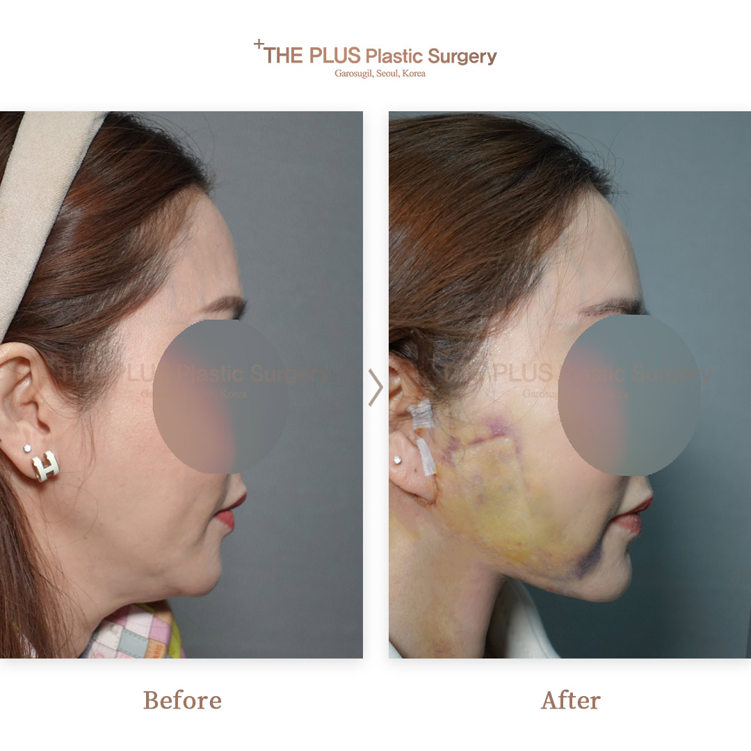 THE PLUS CLINIC KOREA -