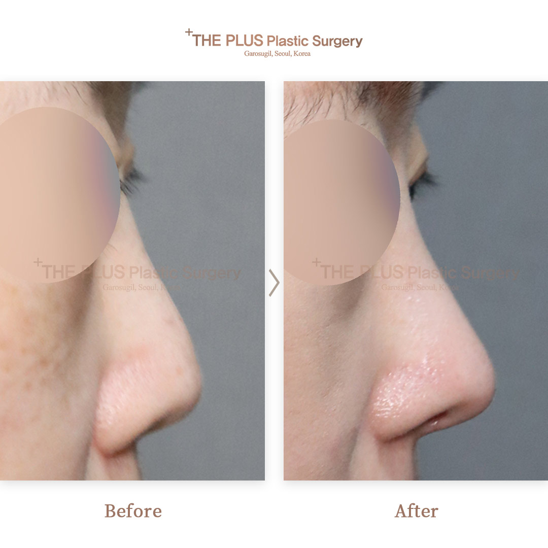THE PLUS CLINIC KOREA -