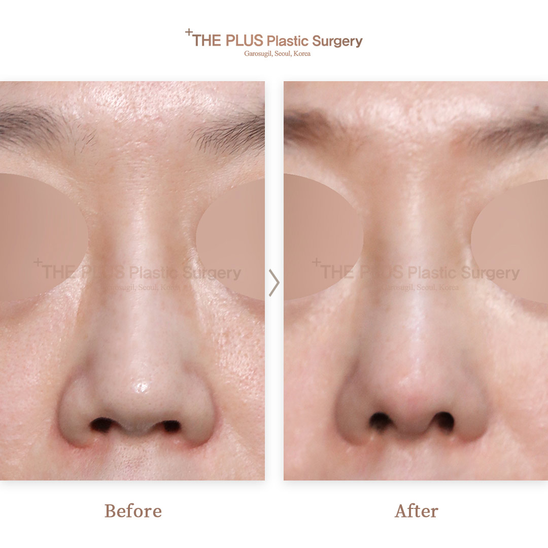 THE PLUS CLINIC KOREA -