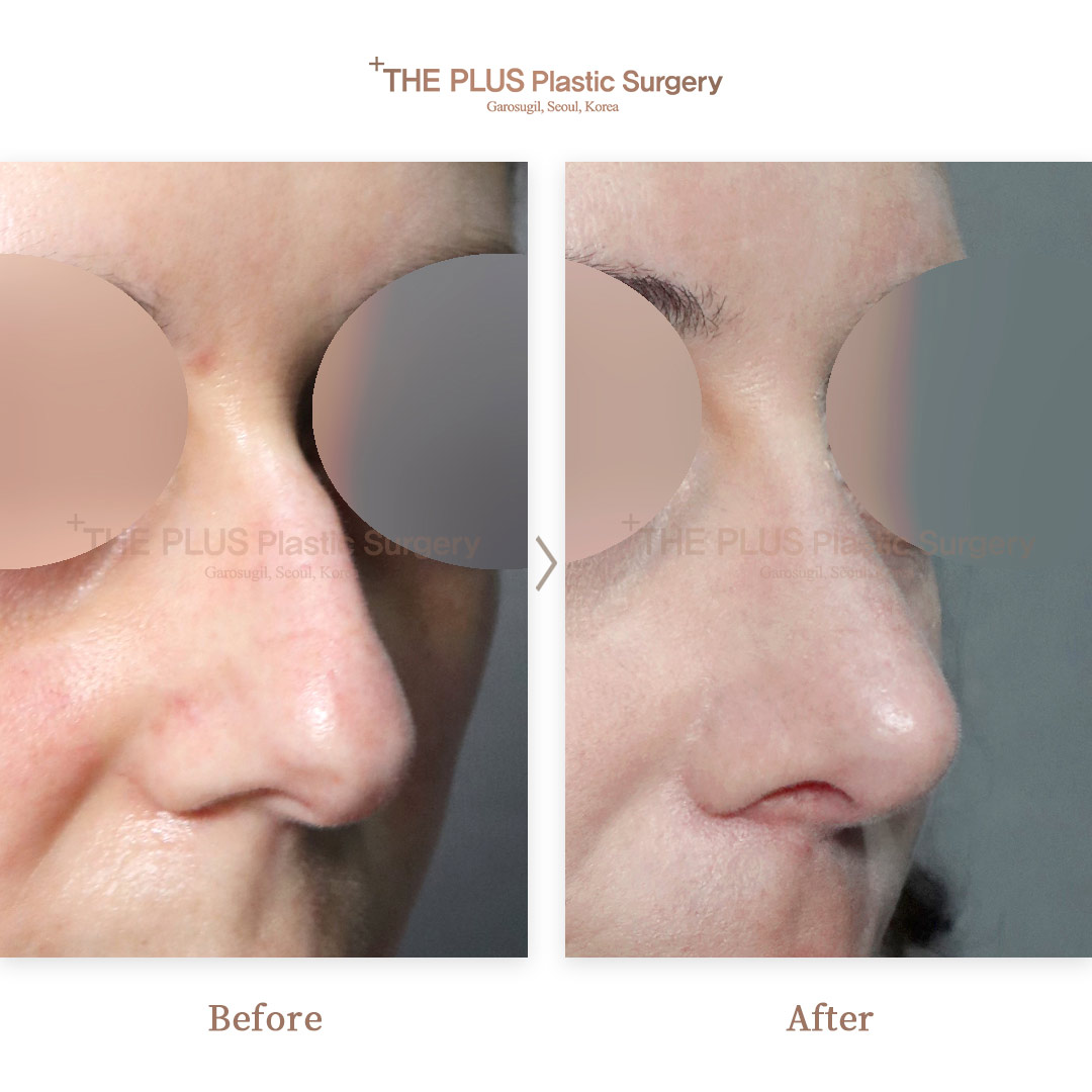 THE PLUS CLINIC KOREA -