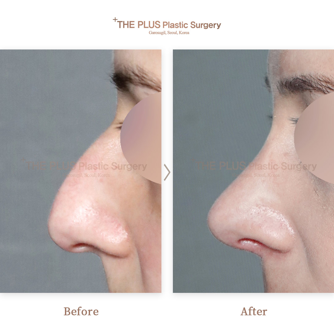 THE PLUS CLINIC KOREA -