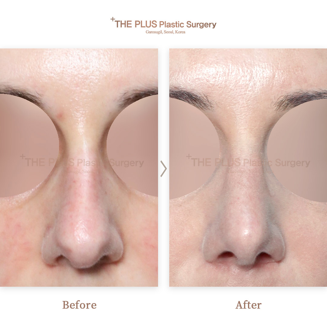THE PLUS CLINIC KOREA -
