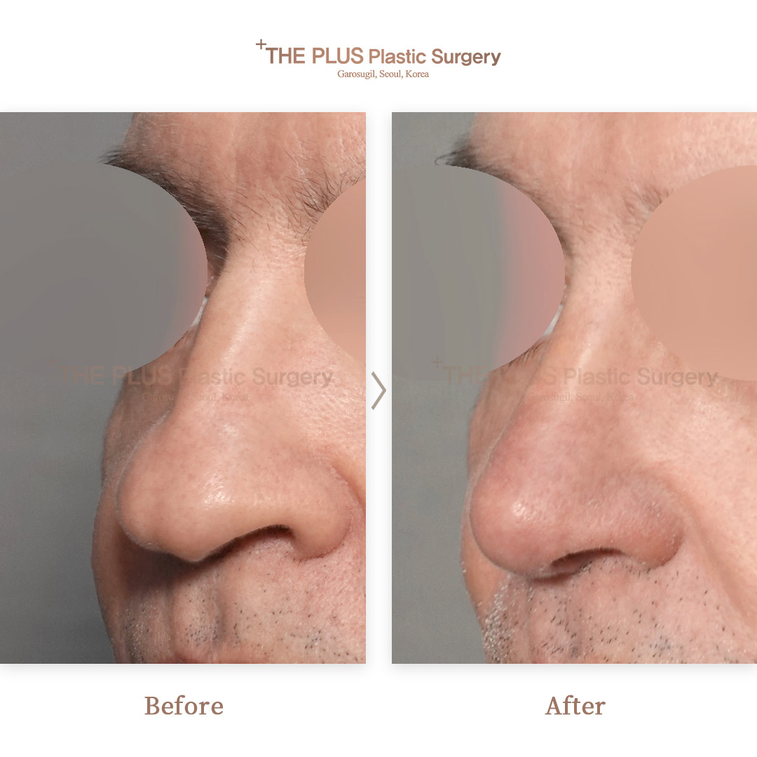 THE PLUS CLINIC KOREA -