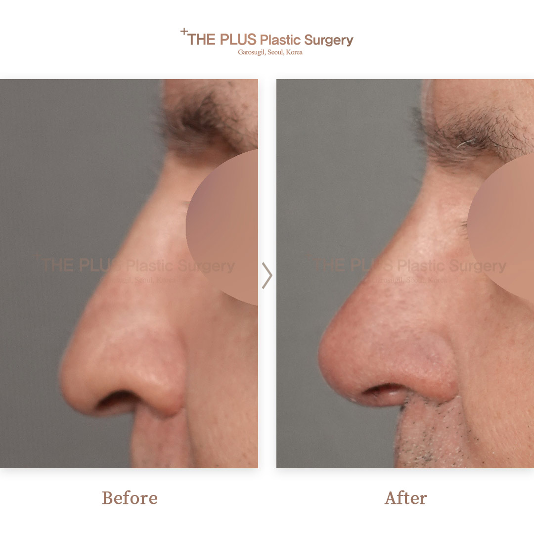 THE PLUS CLINIC KOREA -