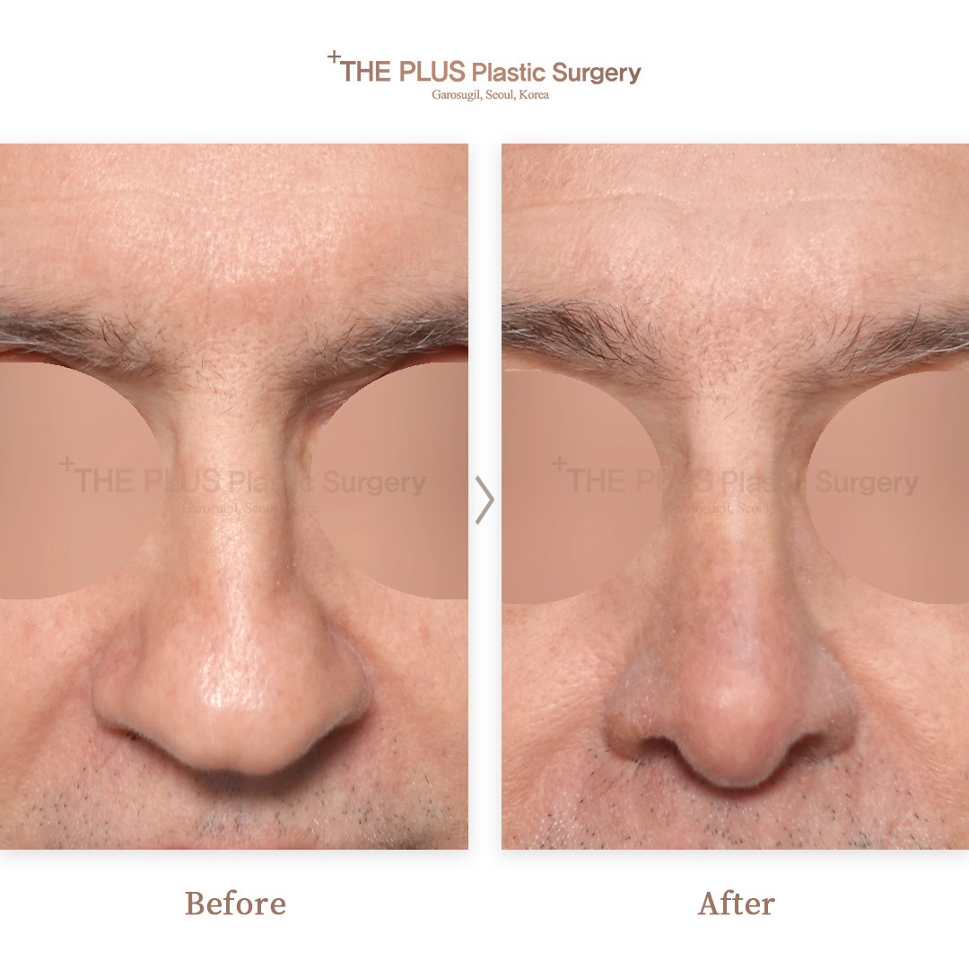 THE PLUS CLINIC KOREA -