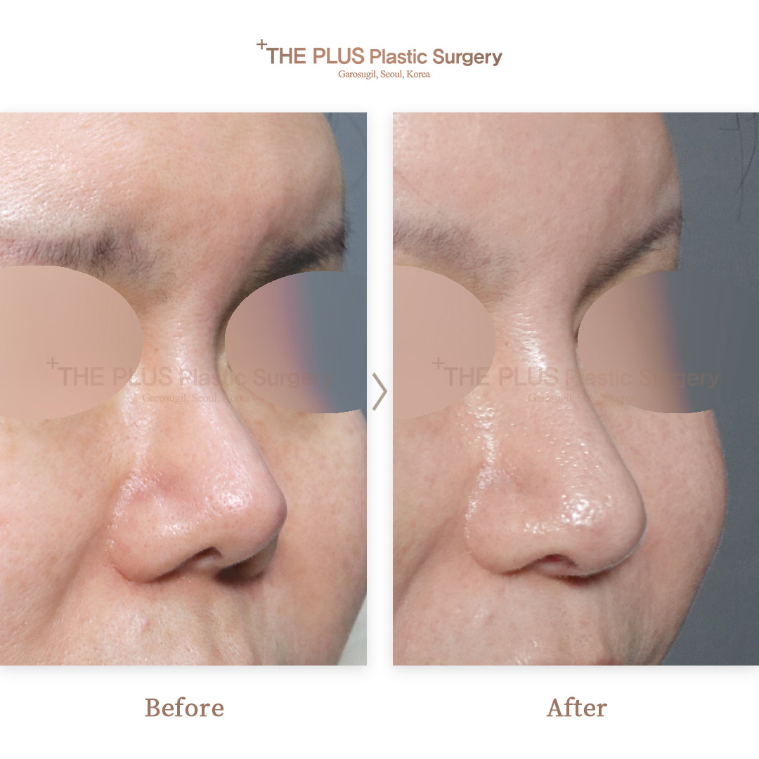 THE PLUS CLINIC KOREA -
