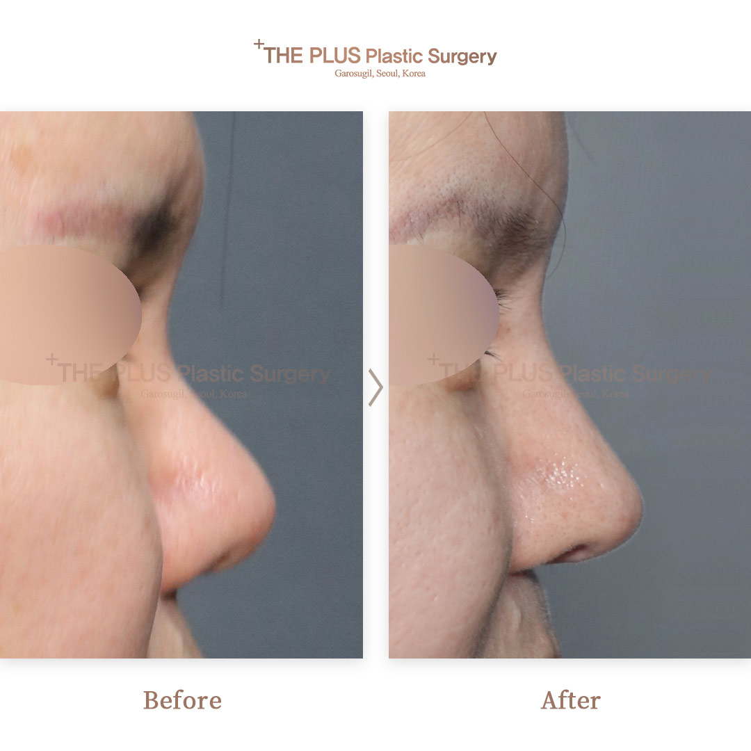 THE PLUS CLINIC KOREA -
