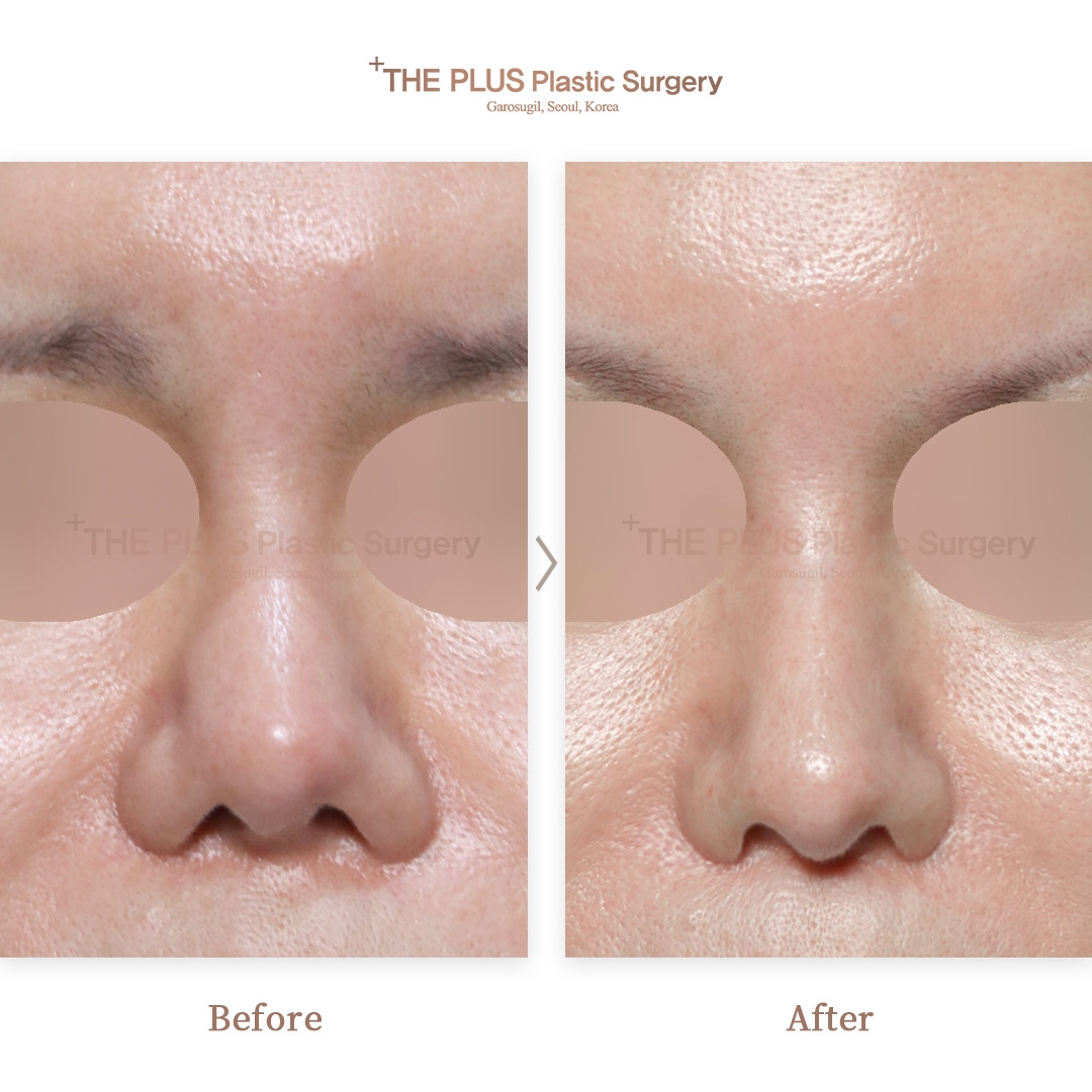 THE PLUS CLINIC KOREA -