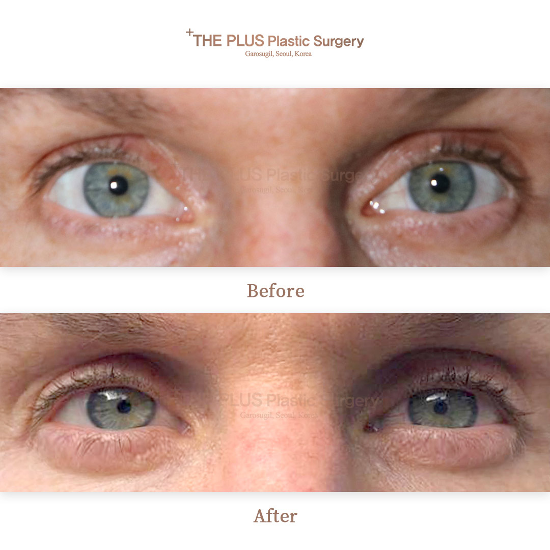 THE PLUS CLINIC KOREA -
