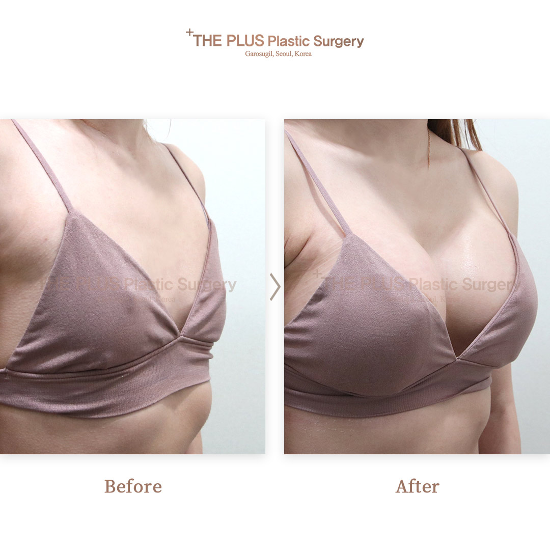 THE PLUS CLINIC KOREA -