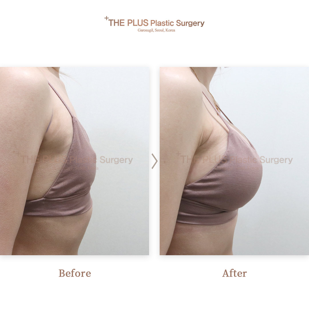THE PLUS CLINIC KOREA -