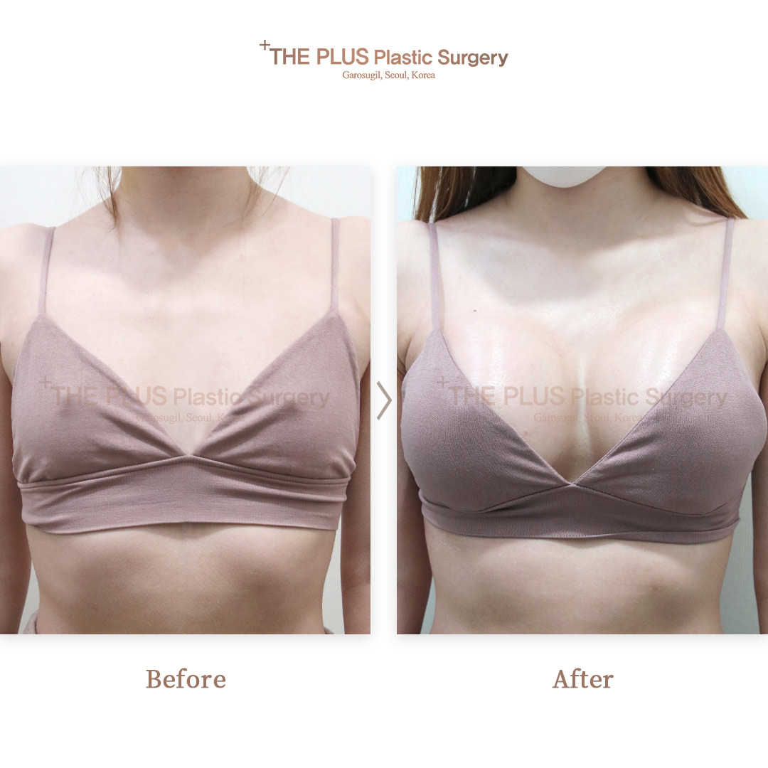 THE PLUS CLINIC KOREA -