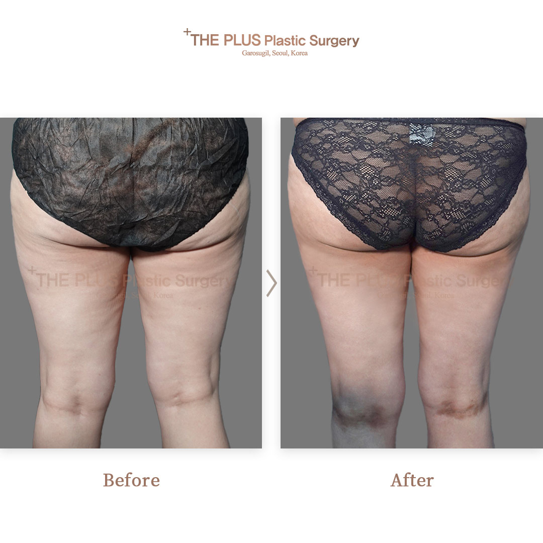 THE PLUS CLINIC KOREA -