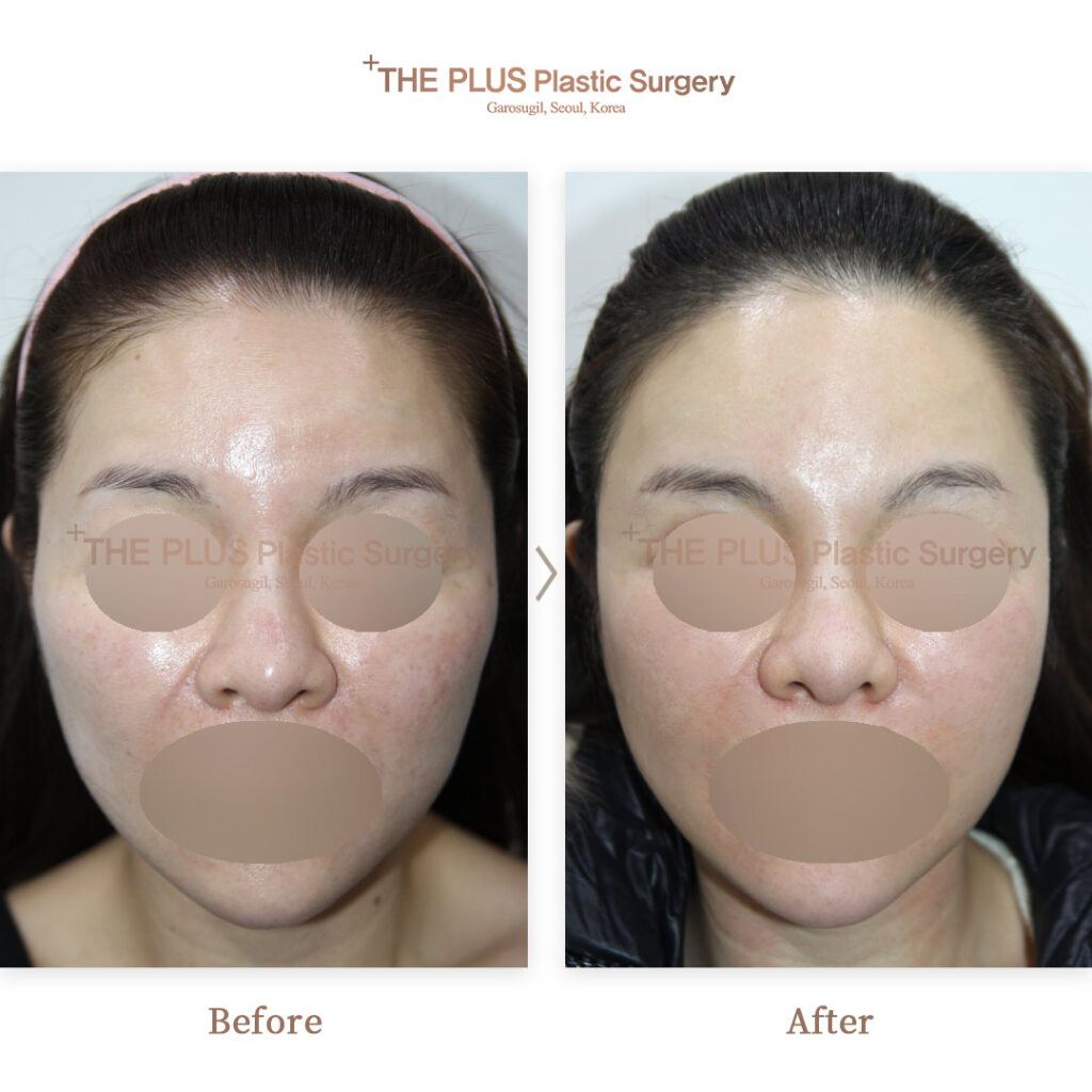 THE PLUS CLINIC KOREA -