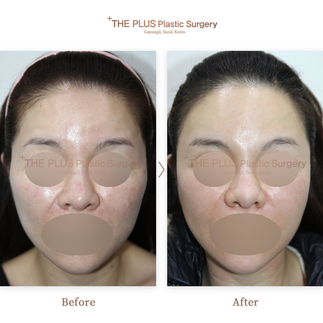 THE PLUS CLINIC KOREA -