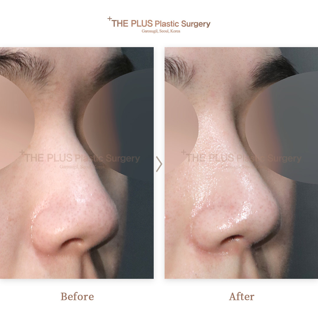 THE PLUS CLINIC KOREA -