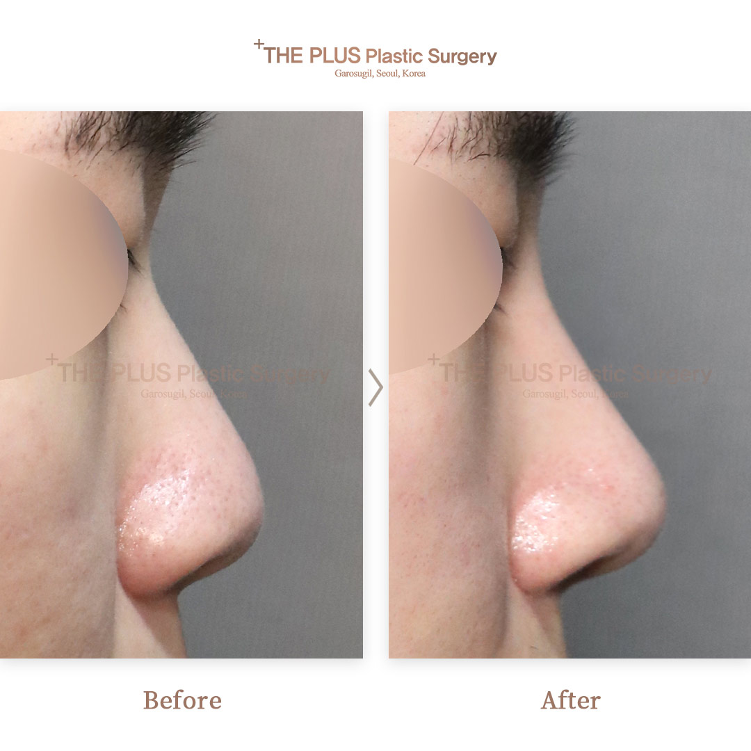 THE PLUS CLINIC KOREA -