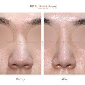 THE PLUS CLINIC KOREA -