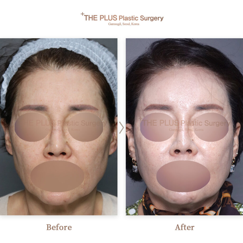 THE PLUS CLINIC KOREA -