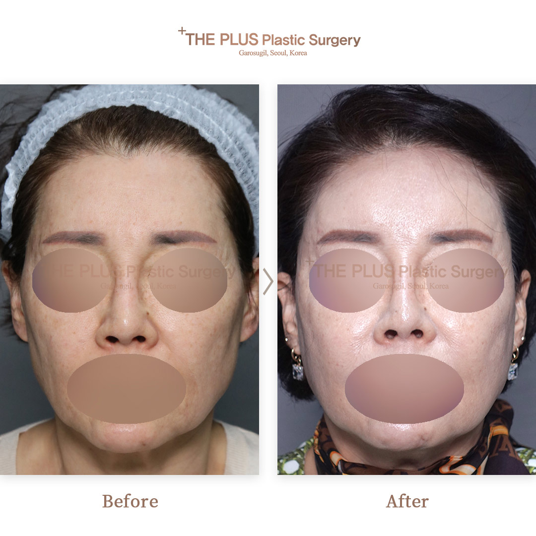 THE PLUS CLINIC KOREA -