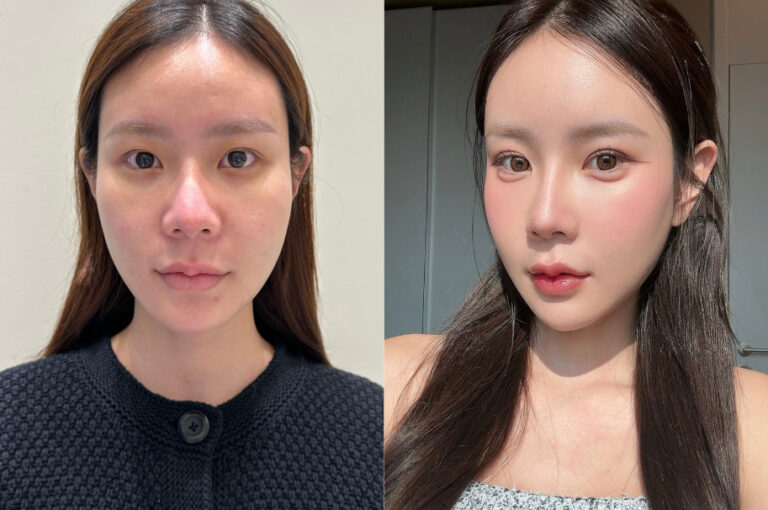 Hong’s Real Review | My All-in-One Face and Body Transformation at ThePlus