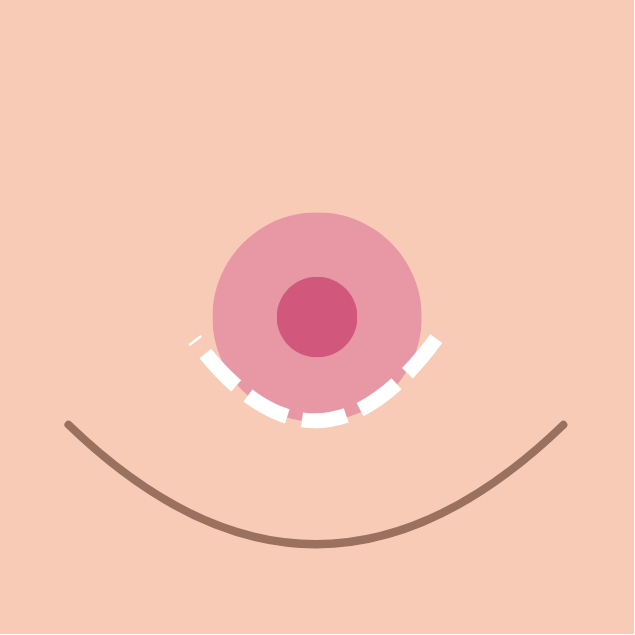 breast implants in korea the plus plastic surgery gangnam