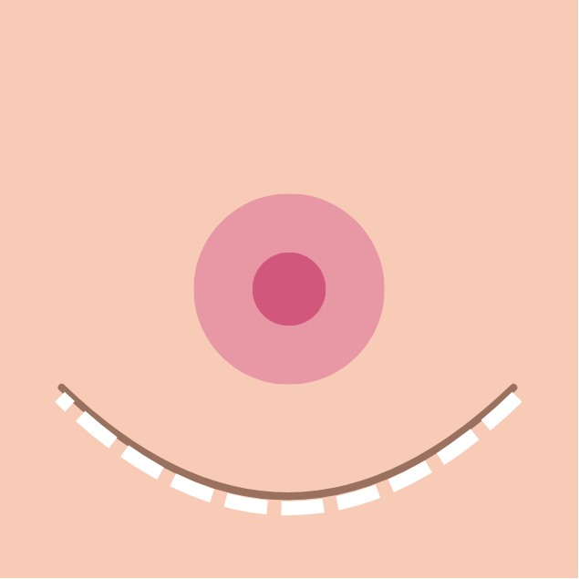 breast implants in korea the plus plastic surgery gangnam