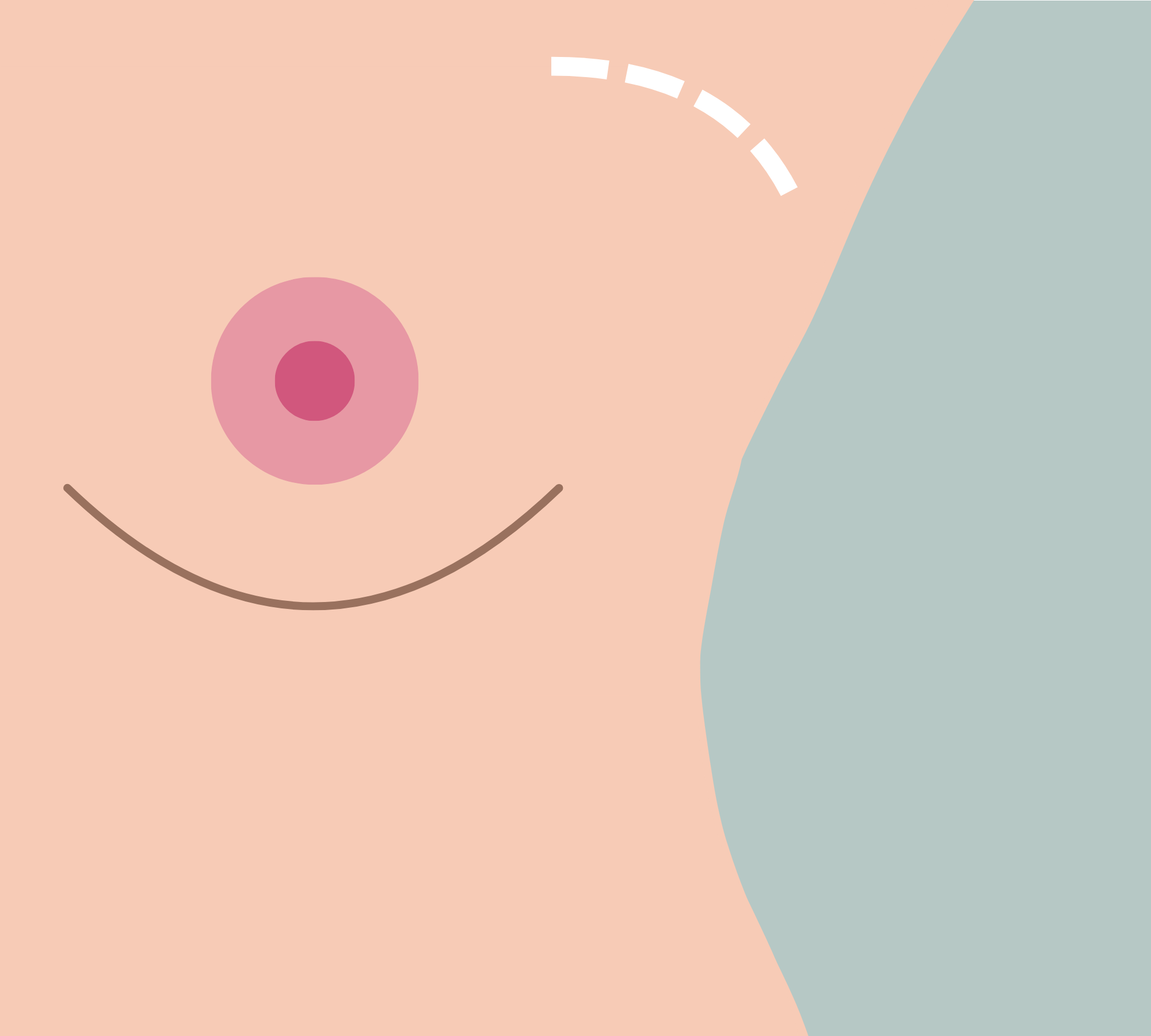 breast implants in korea the plus plastic surgery gangnam