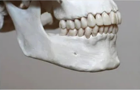 face implant surgery in Korea the plus plastic surgery gangnam