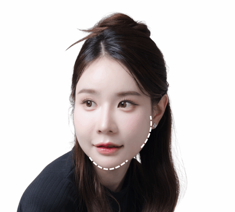 face contouring in Korea the plus plastic surgery gangnam