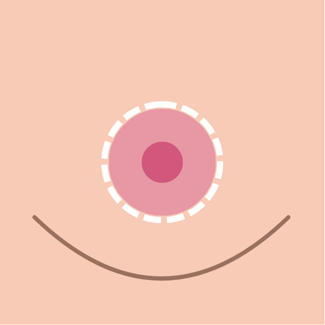 breast reduction in korea the plus plastic surgery gangnam seoul