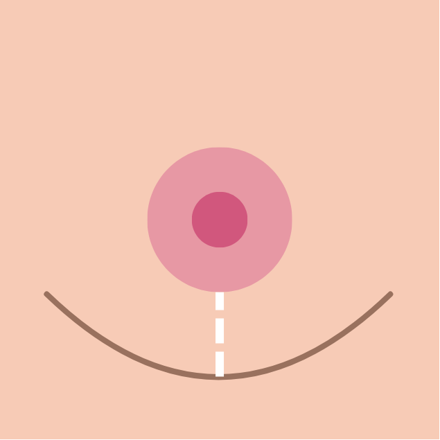 breast reduction in korea the plus plastic surgery gangnam seoul