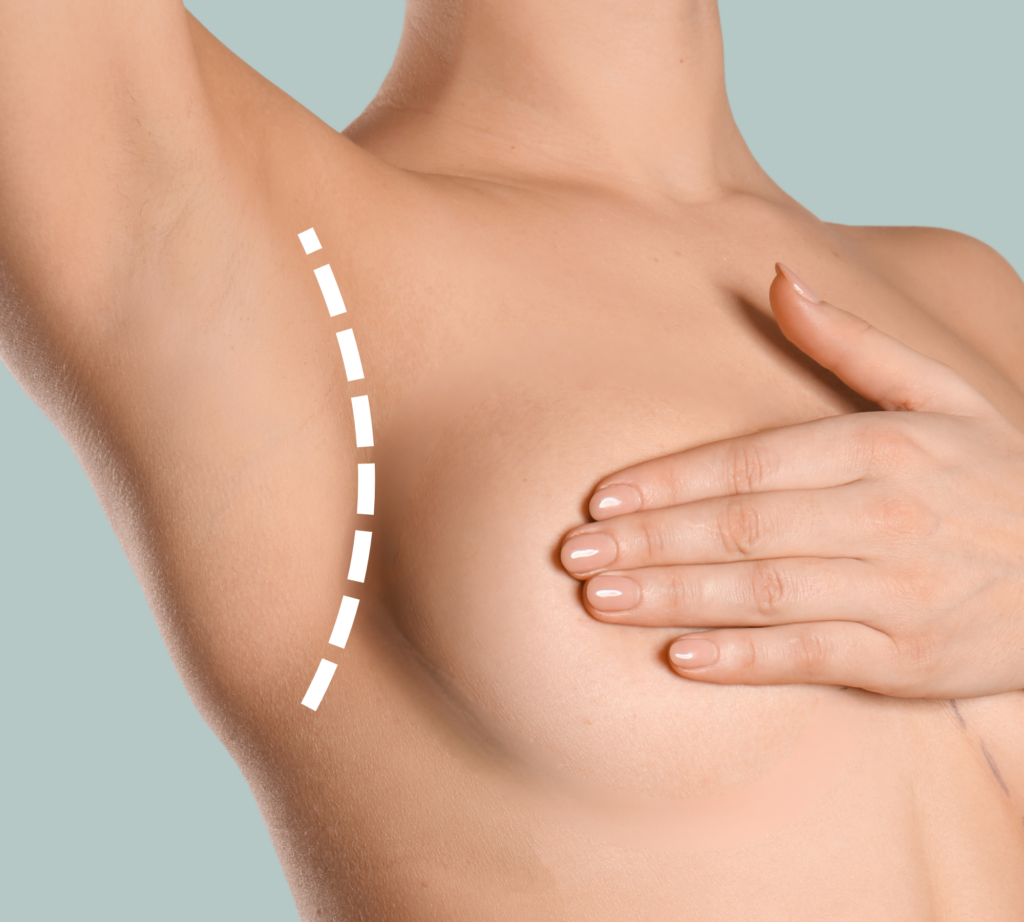 breast reduction in korea the plus plastic surgery gangnam seoul